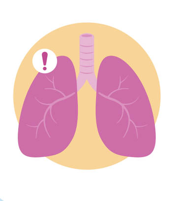 Illustration of lungs with an exclamation point laid over illustration