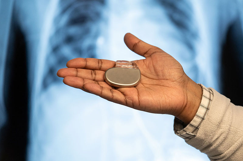 Person holds in their hand a pacemaker