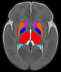 grey brain with center parts in pink, orange, blue, red, and teal