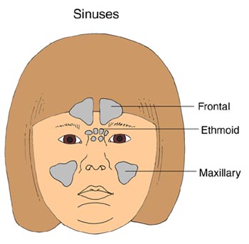 Types of sinuses that could be affected by sinusitis: Frontal, ethmoid, and maxillary.