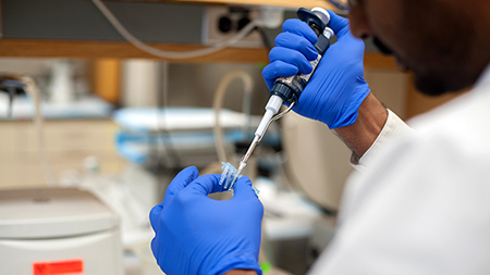 Research inserting specimen into test tube for pediatric kidney transplant research