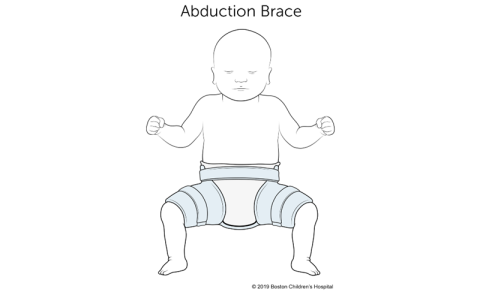 This is an abduction brace.
