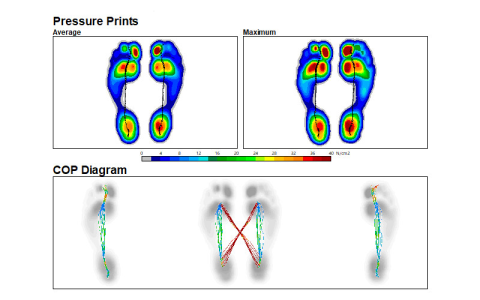 Image of a gait report