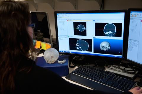 Two computer monitors side by side with the left screen showing four different perspectives of a human cranium; the right computer screen is mostly cut off.