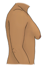 illustration of male body from side perspective with saggy, enlarged breasts